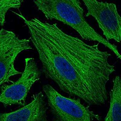 Immunocytochemistry/ Immunofluorescence: SMCP Antibody (5C10D8) - BSA Free [NBP2-37253]