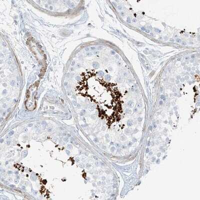 Immunohistochemistry-Paraffin: SMCP Antibody [NBP1-81252]