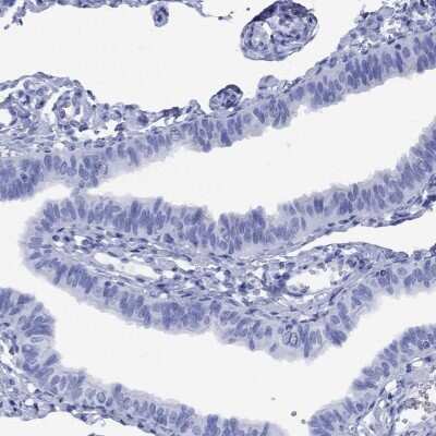 Immunohistochemistry-Paraffin: SMCP Antibody [NBP3-17066]