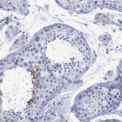 Immunohistochemistry-Paraffin: SMCP Antibody [NBP3-17066]