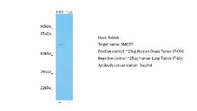 Western Blot: SMCR7 Antibody [NBP2-85778]