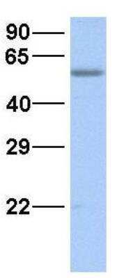 Western Blot: SMCR7L Antibody [NBP1-59480]
