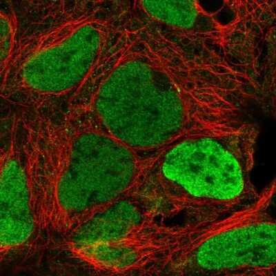 Immunocytochemistry/ Immunofluorescence: SMCX Antibody [NBP2-55541]