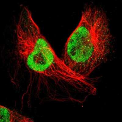 Immunocytochemistry/ Immunofluorescence: SMEK2 Antibody [NBP1-83882]