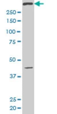 Western Blot: SMG1 Antibody (1A8) [H00023049-M02]