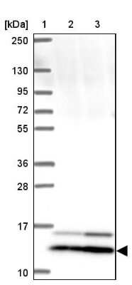 Western Blot: SMIM12 Antibody [NBP2-38066]