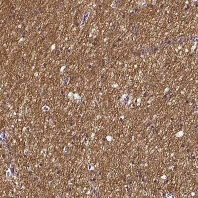Immunohistochemistry-Paraffin: SMIM17 Antibody [NBP2-57922]