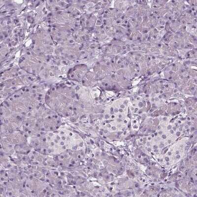 Immunohistochemistry-Paraffin: SMIM17 Antibody [NBP2-57922]