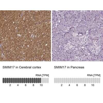 Immunohistochemistry-Paraffin: SMIM17 Antibody [NBP2-57922]