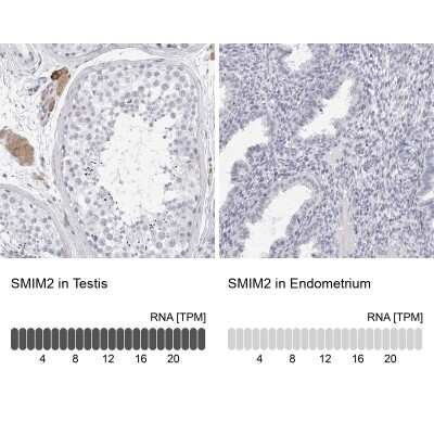 Immunohistochemistry-Paraffin: SMIM2 Antibody [NBP2-47269]
