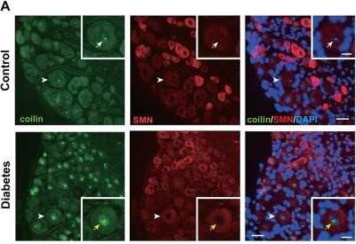 Immunohistochemistry: SMN Antibody (2B1) - Azide and BSA Free [NBP2-80955]