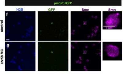 Immunocytochemistry/ Immunofluorescence: SMN Antibody (2B1) [NB100-1936]