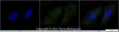 Immunocytochemistry/ Immunofluorescence: SMN Antibody (2B1) [NB100-1936]