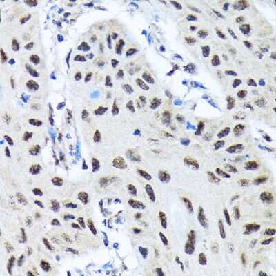 Immunohistochemistry-Paraffin: SMN Antibody (9N9Q6) [NBP3-16863]