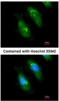 Immunocytochemistry/ Immunofluorescence: SMN Antibody [NBP1-32021]