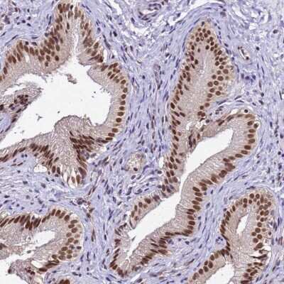 Immunohistochemistry-Paraffin: SMN Antibody [NBP2-46712]