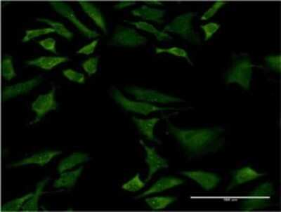 Immunocytochemistry/ Immunofluorescence: SMN2 Antibody (1A3-2B9) [H00006607-M02]