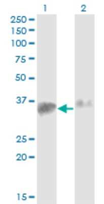 Western Blot: SMN2 Antibody (1A3-2B9) [H00006607-M02]