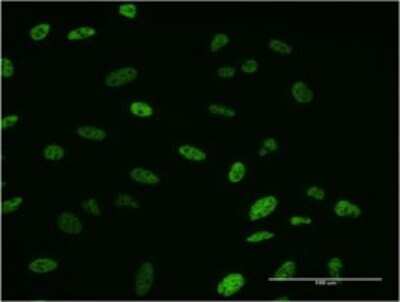 Immunocytochemistry/ Immunofluorescence: SMN2 Antibody (2B11-2A9) [H00006607-M01]