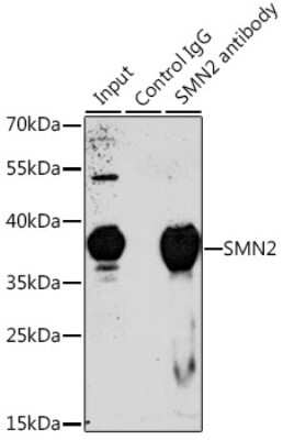 Western Blot: SMN2 AntibodyBSA Free [NBP2-94596]