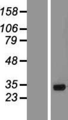 Western Blot: SMN2 Overexpression Lysate [NBP2-06377]