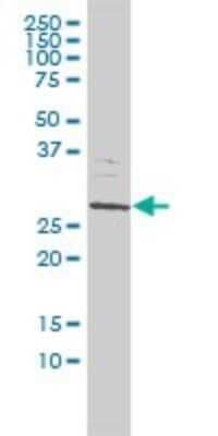 Western Blot: SMNDC1 Antibody (2B9) [H00010285-M01]