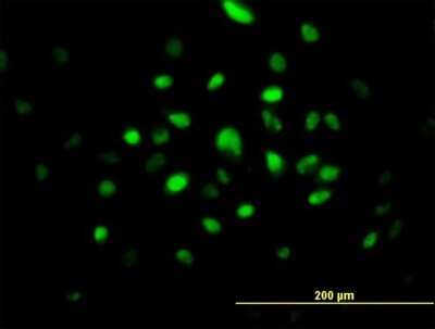 Immunocytochemistry/ Immunofluorescence: SMNDC1 Antibody [H00010285-B01P]