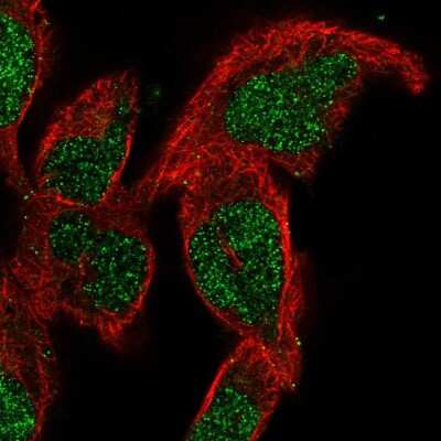 Immunocytochemistry/ Immunofluorescence: SMNDC1 Antibody [NBP2-56111]