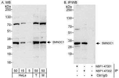 Western Blot: SMNDC1 Antibody [NBP1-47301]