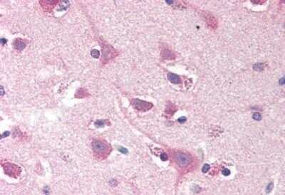 Immunohistochemistry-Paraffin: SMOC-2 Antibody [NBP1-39788]