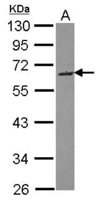 Western Blot: SMOC-2 Antibody [NBP2-20425]