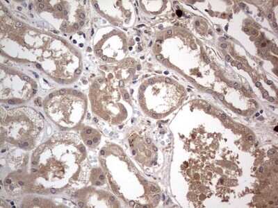 Immunohistochemistry: SMPD1 Antibody (OTI3H7) [NBP2-45889]