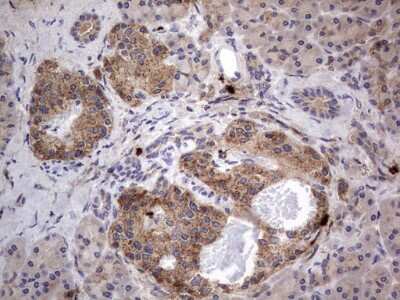 Immunohistochemistry: SMPD1 Antibody (OTI3H7) [NBP2-45889]
