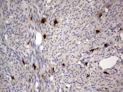 Immunohistochemistry: SMPD1 Antibody (OTI3H7) [NBP2-45889]