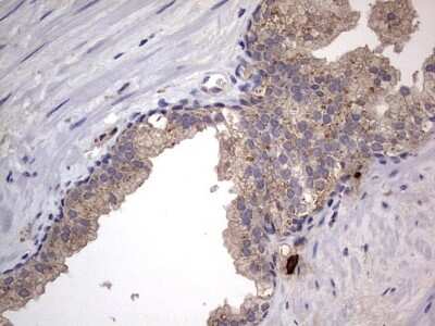 Immunohistochemistry: SMPD1 Antibody (OTI3H7) [NBP2-45889]