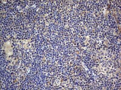 Immunohistochemistry: SMPD1 Antibody (OTI3H7) [NBP2-45889]