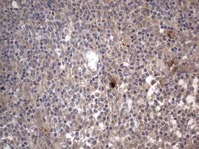 Immunohistochemistry: SMPD1 Antibody (OTI3H7) [NBP2-45889]