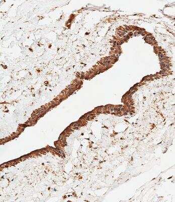 Immunohistochemistry-Paraffin: SMPD1 Antibody [NBP2-22365]