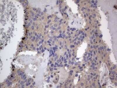 Immunohistochemistry: SMPD1 Antibody (OTI3H7) - Azide and BSA Free [NBP2-74240]
