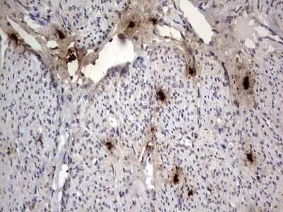 Immunohistochemistry: SMPD1 Antibody (OTI3H7) - Azide and BSA Free [NBP2-74240]