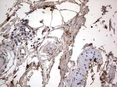 Immunohistochemistry: SMPD1 Antibody (OTI3H7) - Azide and BSA Free [NBP2-74240]