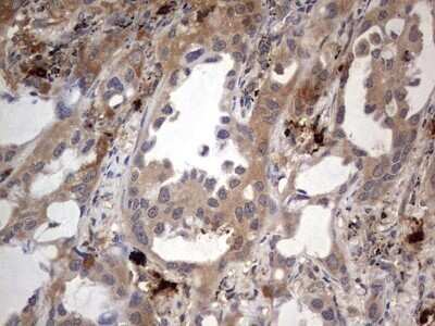 Immunohistochemistry: SMPD1 Antibody (OTI3H7) - Azide and BSA Free [NBP2-74240]