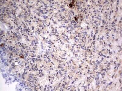 Immunohistochemistry: SMPD1 Antibody (OTI3H7) - Azide and BSA Free [NBP2-74240]