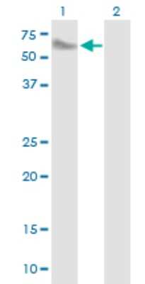 Western Blot: SMPDL3A Antibody [H00010924-B01P]
