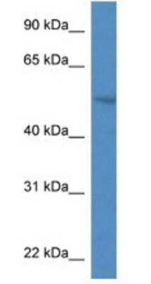 Western Blot: SMPDL3A Antibody [NBP1-74114]