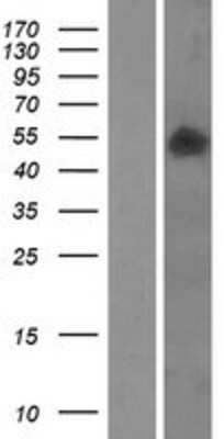 Western Blot: SMPDL3B Overexpression Lysate [NBP2-09865]