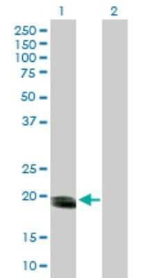 Western Blot: SMUG1 Antibody [H00023583-B01P]
