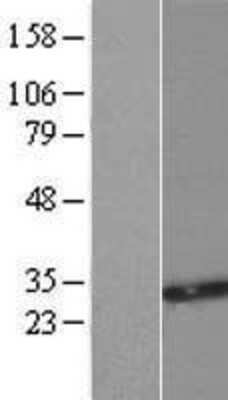Western Blot: SMUG1 Overexpression Lysate [NBP2-07355]