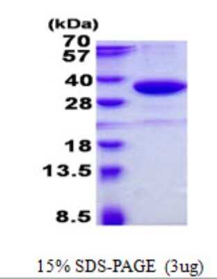 SDS-PAGE: Recombinant Human SMUG1 His Protein [NBP2-22806]