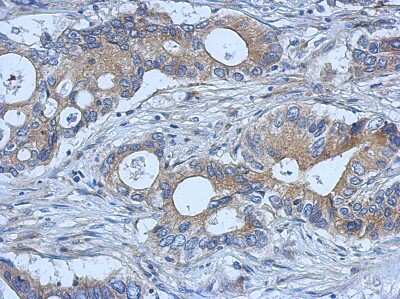 Immunohistochemistry-Paraffin: SMURF2 Antibody [NBP2-20427]